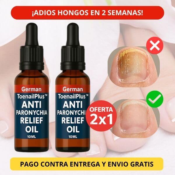 ANTY PARONYCHIA RELIEF OIL – Tratamiento rápido antifúngico para uñas Premium  compra 1 te regalamos el OTRO 2 X 1 APROVECHA!
