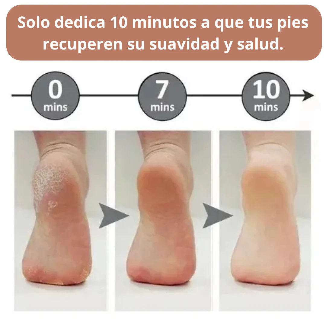 PediPro Max® – Tu Spa Portátil para Pies Suaves y Sin Callos